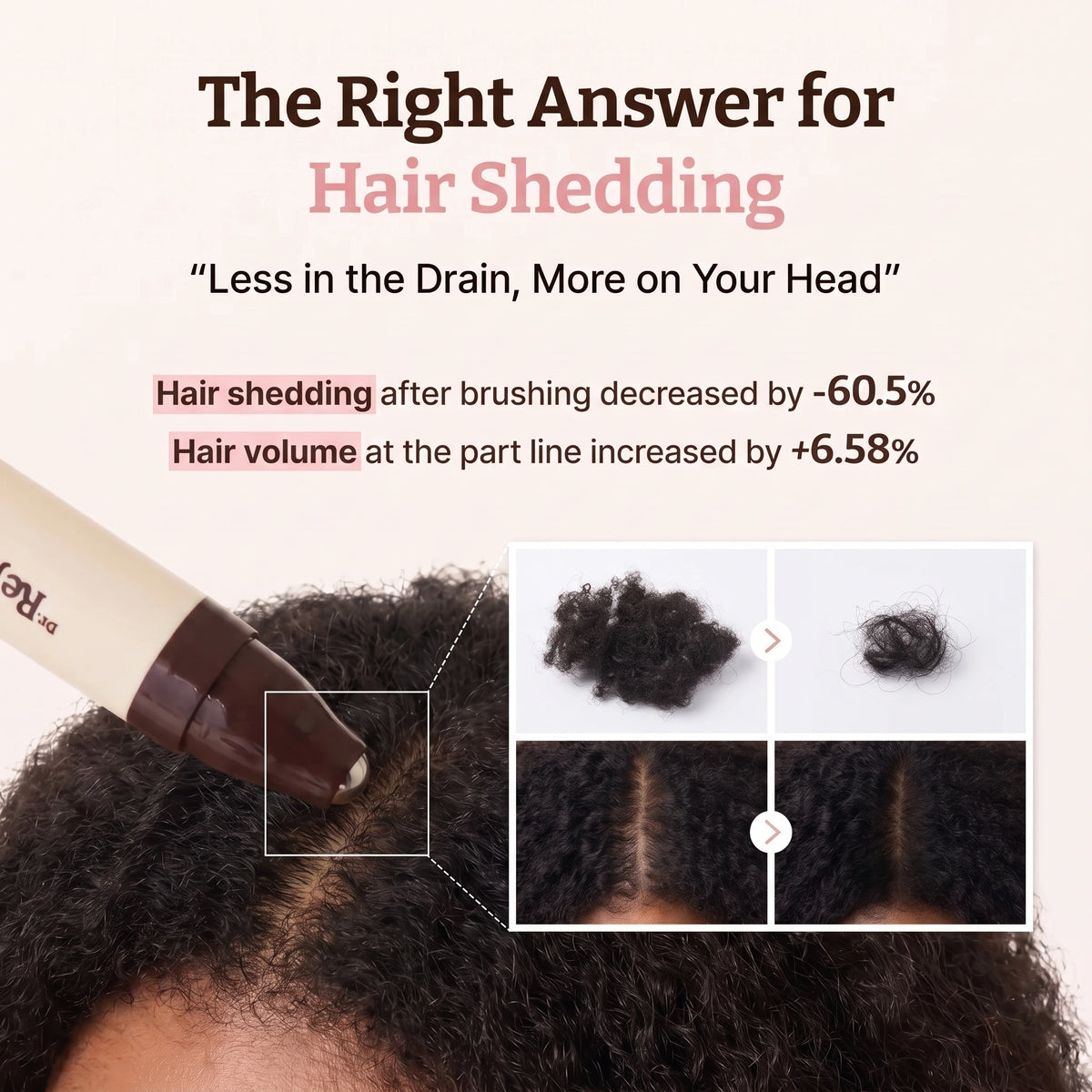 PDRN Density Scalp Roll-On